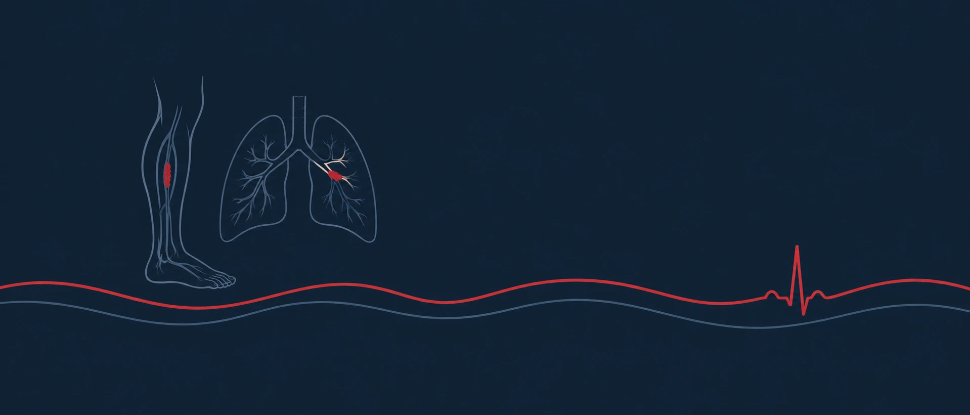 Deep Vein Thrombosis & Pulmonary Embolism