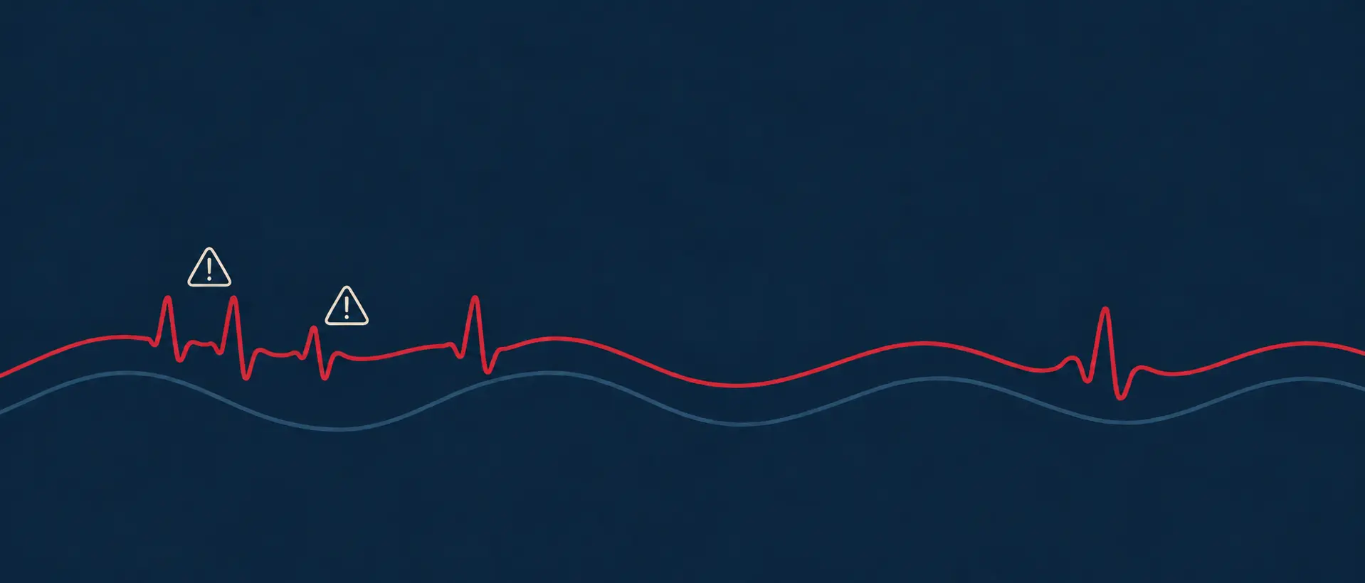 Palpitations & Arrhythmias